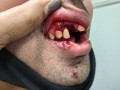 الشرطة اصابة شاب  بجروح وكسر فك اسنانه و يديه.